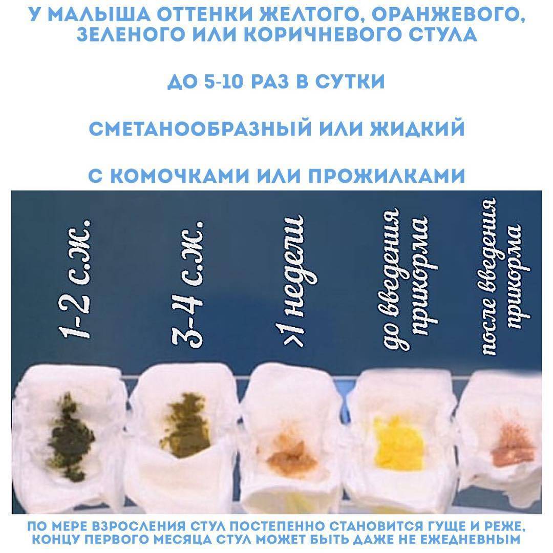 Какой стул должен быть у новорожденного на грудном вскармливании?