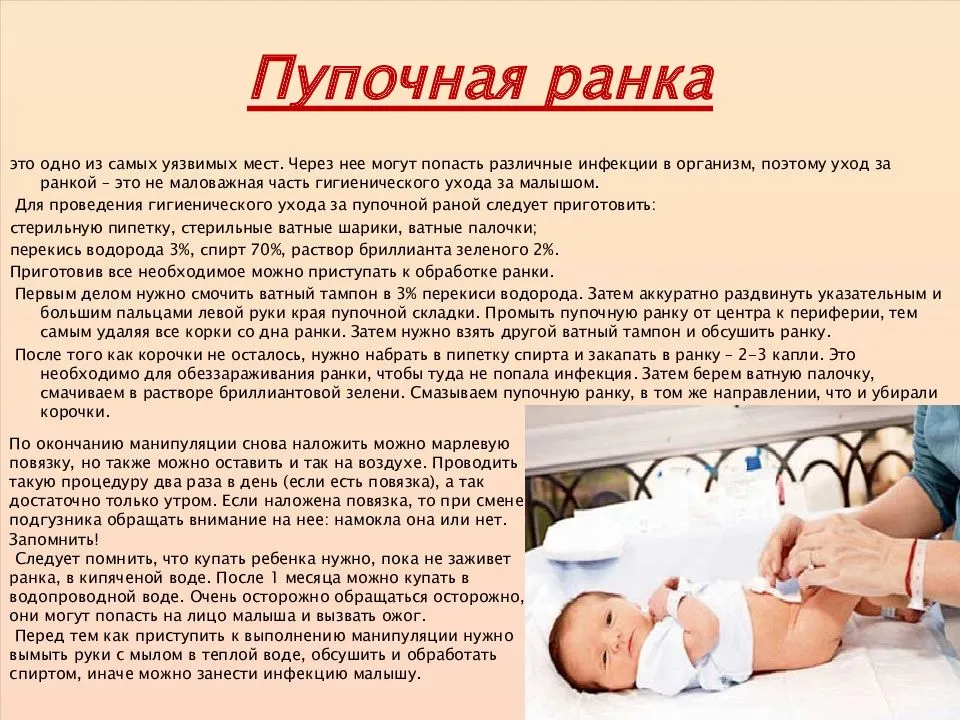 Как обрабатывать пупок новорождённого