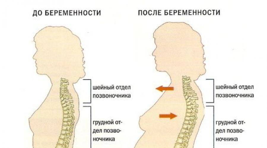 Ломит кости при беременности. Спина при беременности. Позвоночник при беременности. Болит поясница при беременности. Позвоночник беременной женщины.