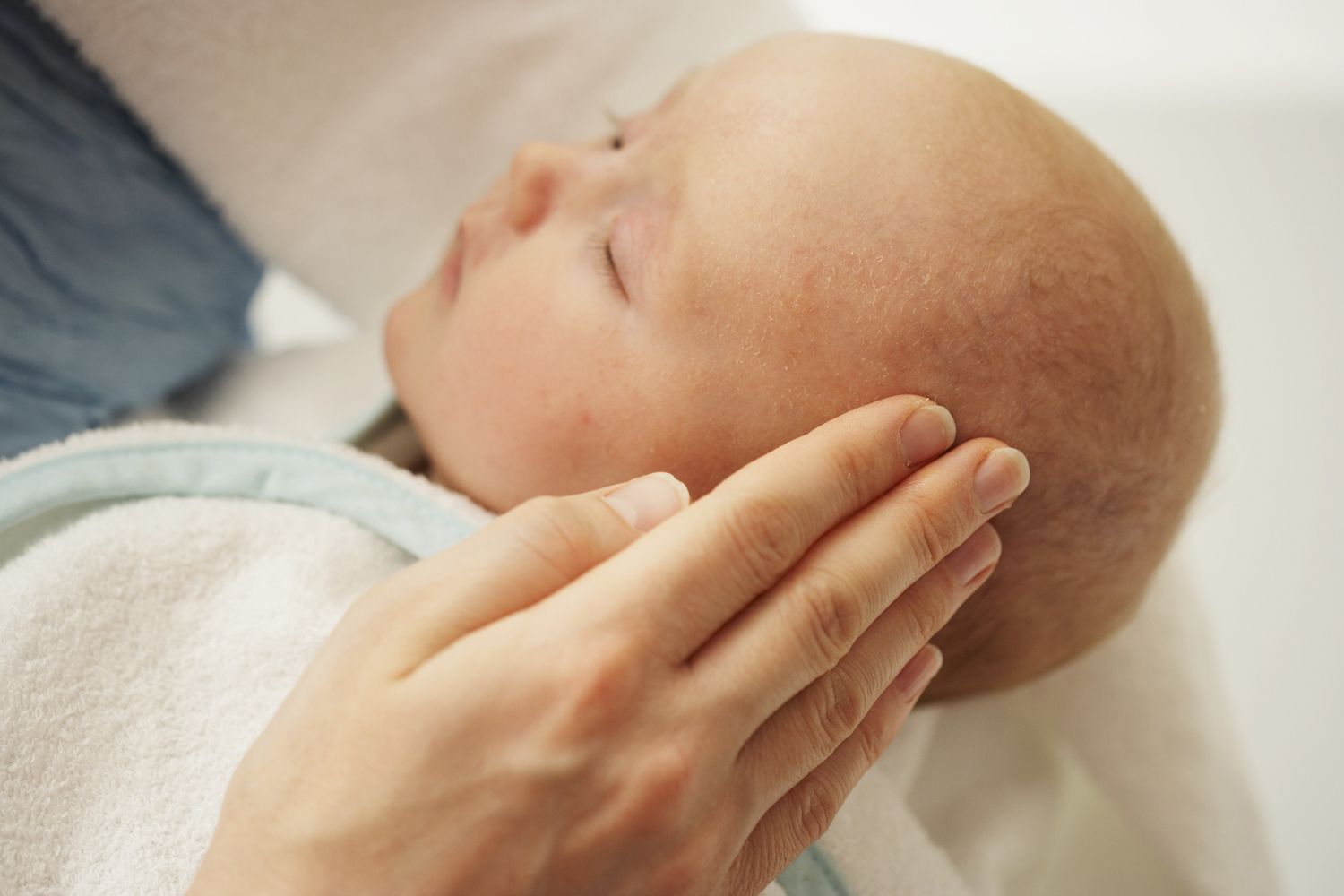 Почему шелушится кожа у новорожденного: причины, лечение