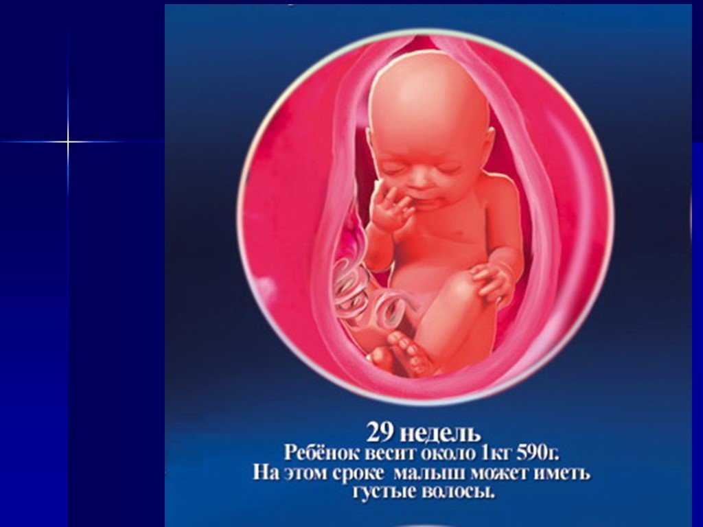 29 неделя беременности рост плода, шевеления, выделения, матка, боли в животе, узи - умкамама.ру