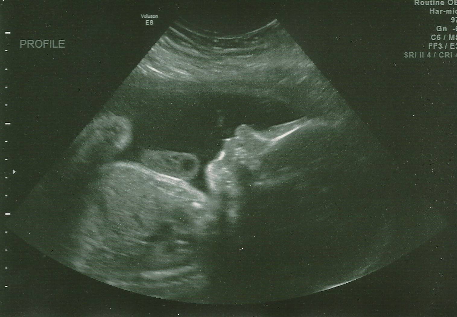 28 неделя беременности: что происходит с малышом и мамой, как выглядит ребенок?