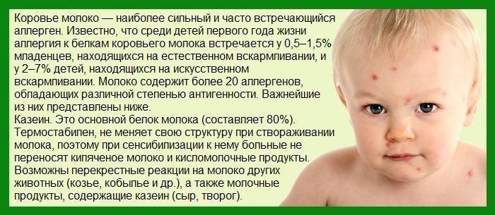 Опрелости у новорожденных детей