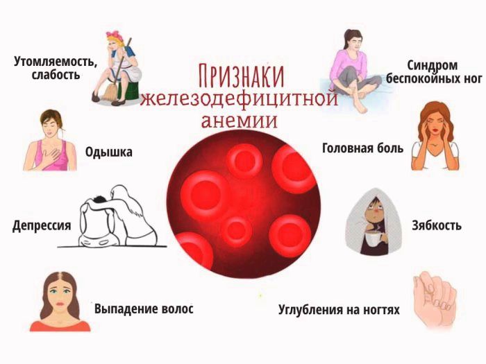 Анемия у детей. причины, симптомы, диагностика и лечение патологии
