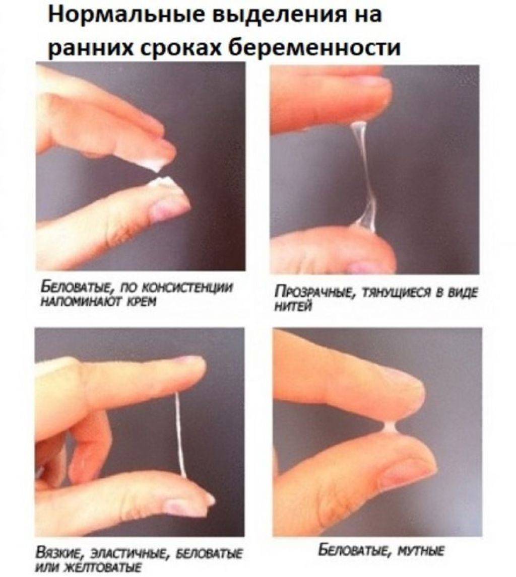 Выделения при беременности