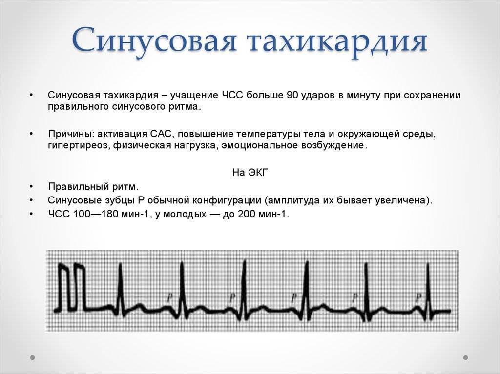 Тахикардия у детей симптомы и лечение, а также 9 методов диагнстики