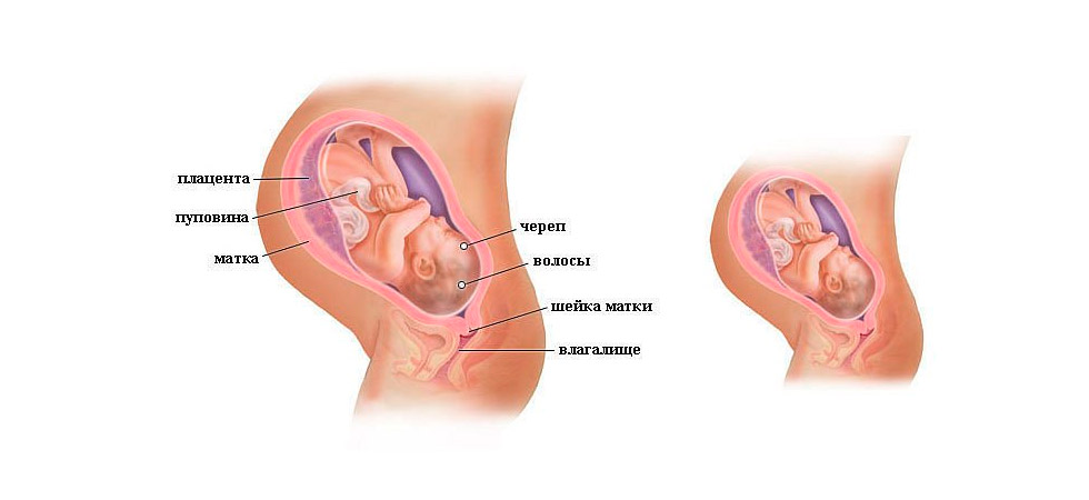 Где Находится Матка При Беременности Фото