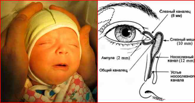 Показания к назначению массажа слезного канала у новорожденных и как правильно делать