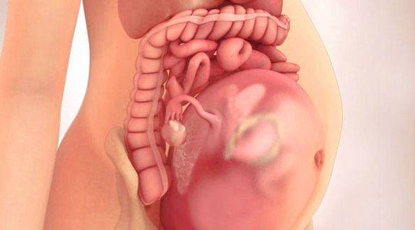 Плод давит. Расположение ребенка в животе.