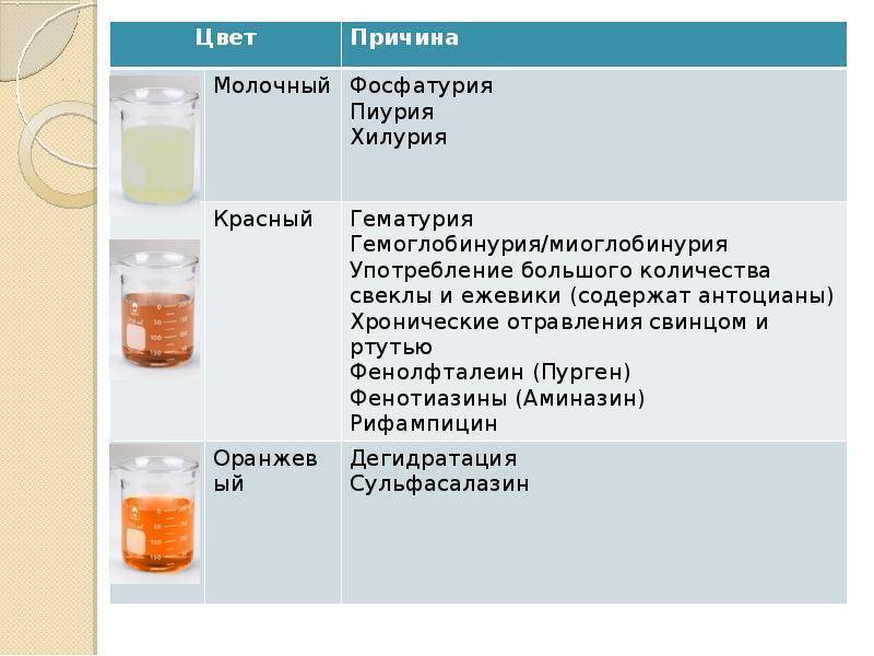 Какой запах должен. Изменение цвета и запаха мочи. Цвет мочи норма у женщин. Цвет и прозрачность мочи в норме. Мутность мочи причины.