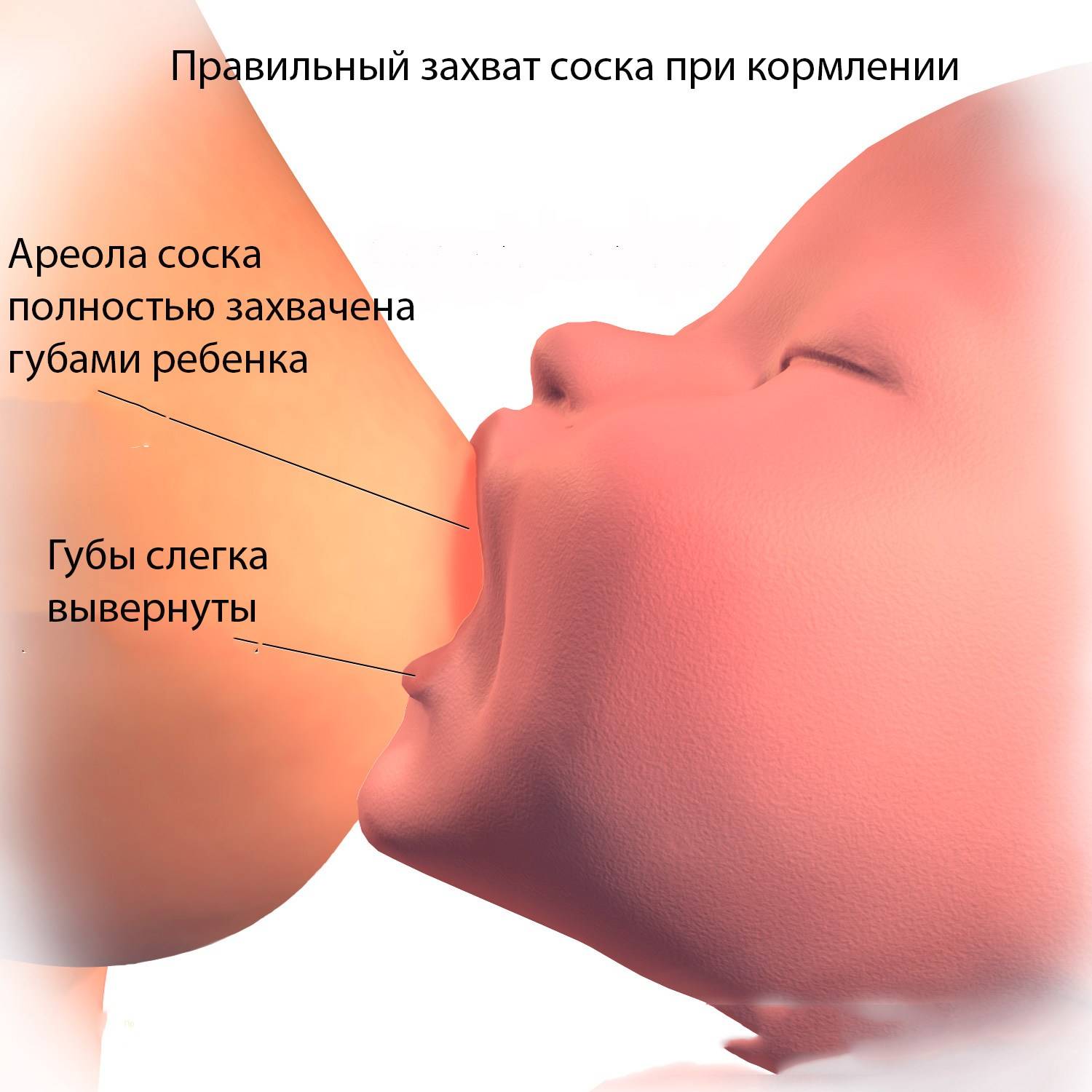 Как кормить ребенка без боли? трещины и ссадины на груди.