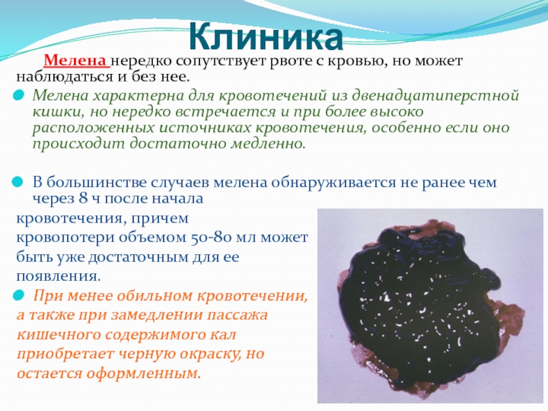 Геморрагическая болезнь новорожденных - симптомы болезни, профилактика и лечение геморрагической болезни новорожденных, причины заболевания и его диагностика на eurolab