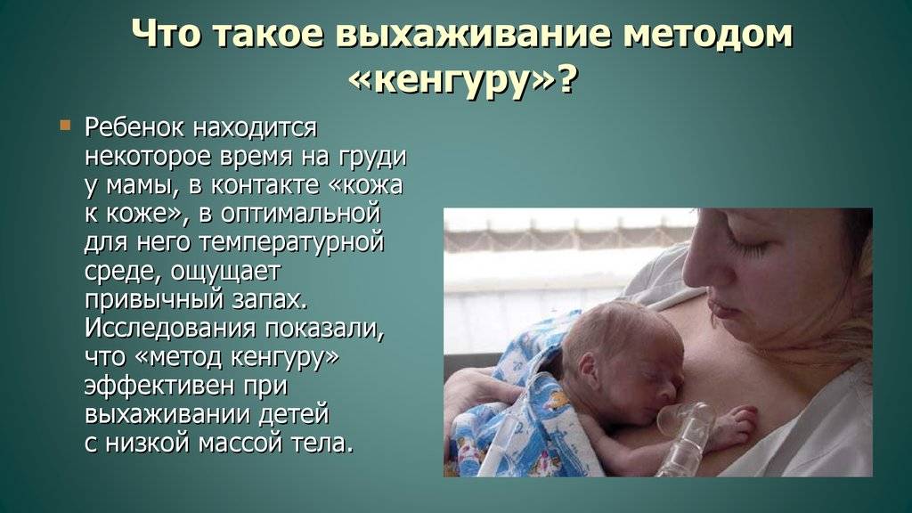 Метод "кенгуру" в выхаживании недоношенных детей