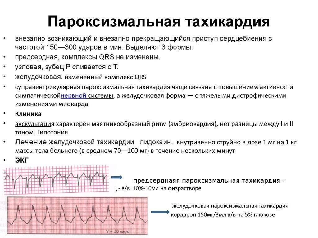 Признаки аритмии у ребенка, причины развития патологии, симптоматика