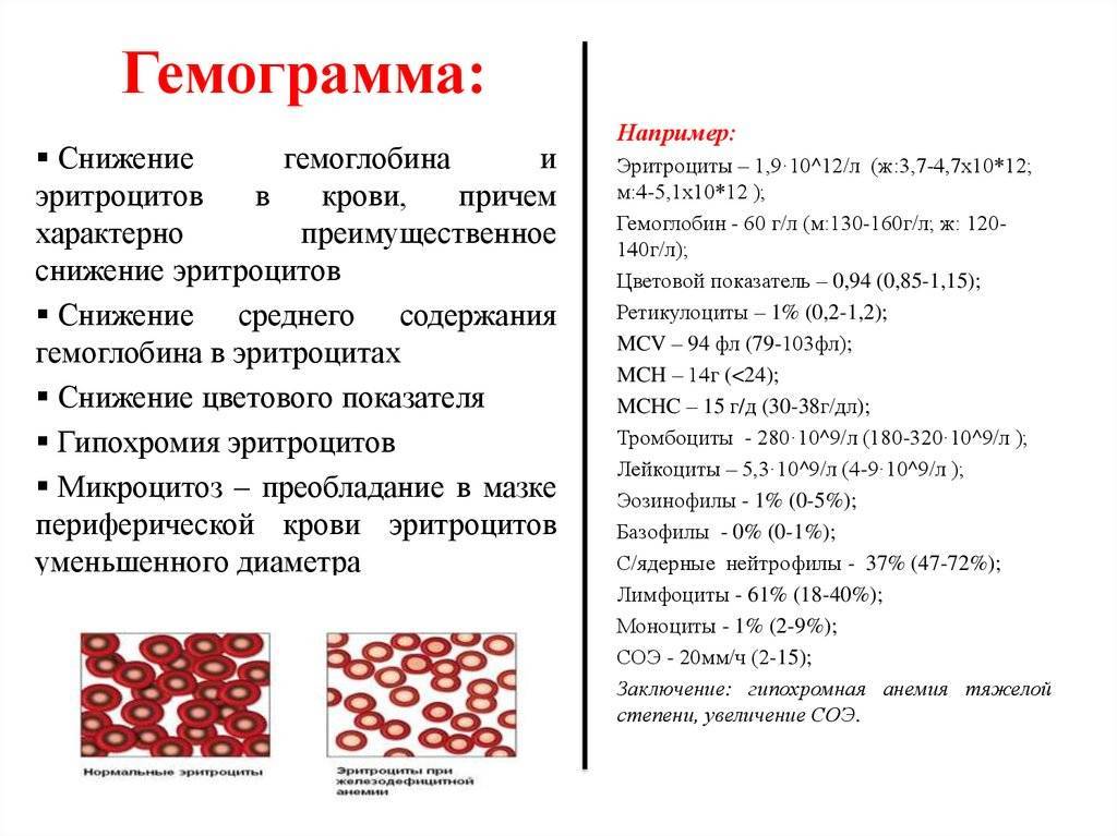 Гемоглобин у грудничка: признаки анемии у грудничка