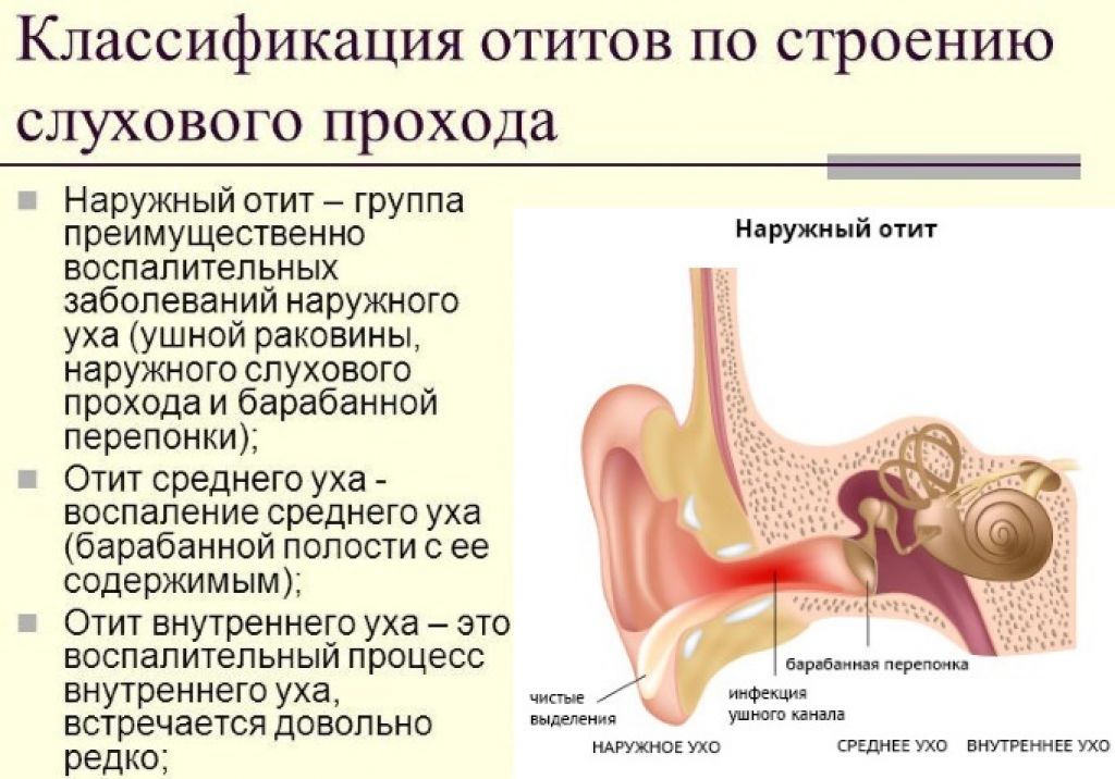 Ушные капли для детей от отита: список лучших детских противовоспалительных лекарств ребенку