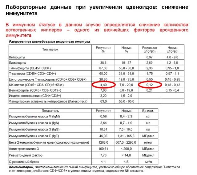 Аденоиды у детей — симптомы, причины и лечение