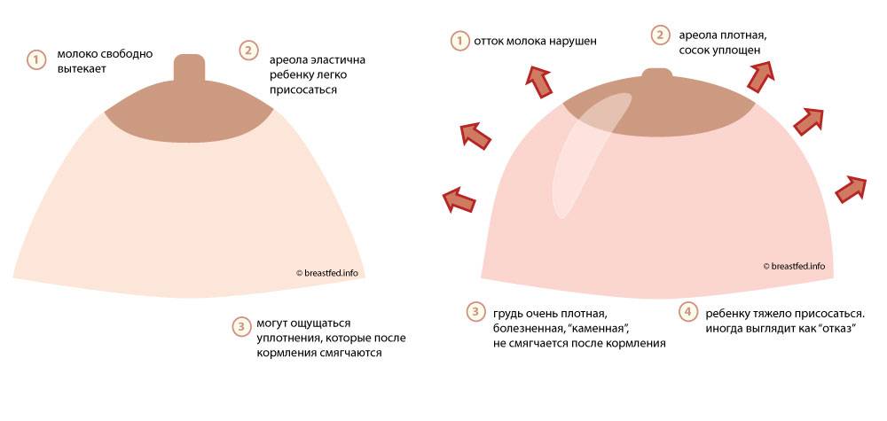 Грудь при беременности. фото, изменение, увеличение, боли, если сдулась, уменьшилась, чешется, набухает, чувствительность
