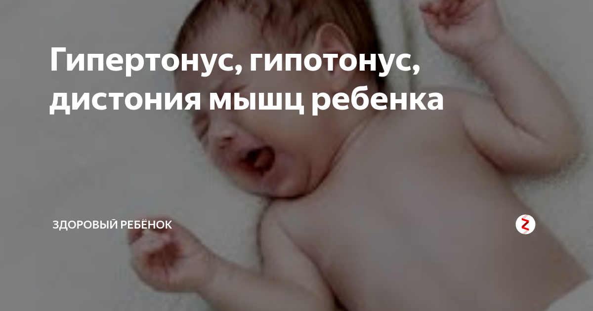 Тонус мышц у грудничка и его нарушения