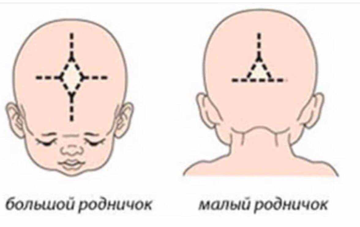Роднички у новорожденных: когда зарастает темечко, нормы закрытия