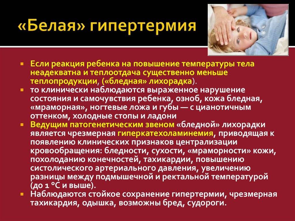 Нужно ли сбивать температуру у детей?
