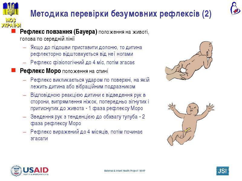 Рефлексы новорожденных: видео, таблица норм, врожденные, причины отсутствия