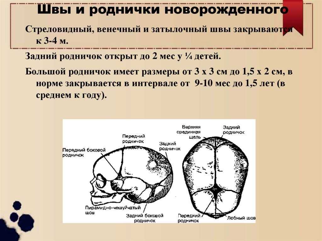 Родничок у новорожденных и всё о нём: где находится, когда зарастает, нормы (большой и маленький)?