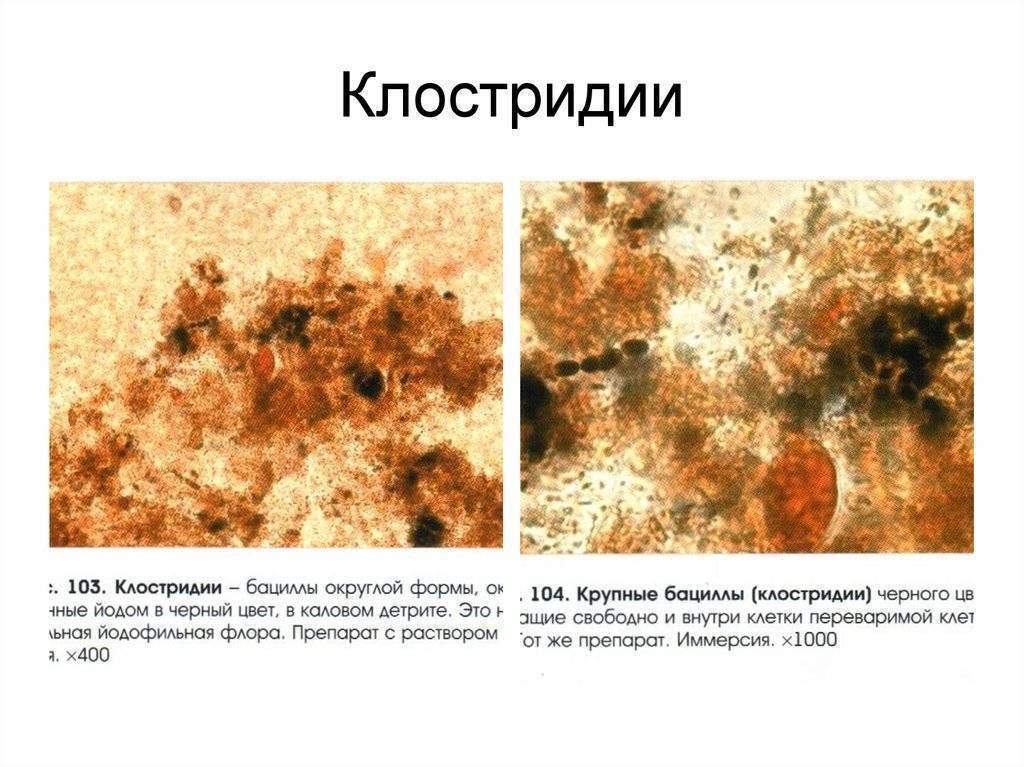Йодофильные бактерии в кале у ребенка: причины возникновения и способы борьбы