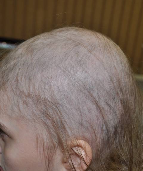 Почему у новорожденного грудничка выпадают волосы на голове: естественные и патологические причины / mama66.ru