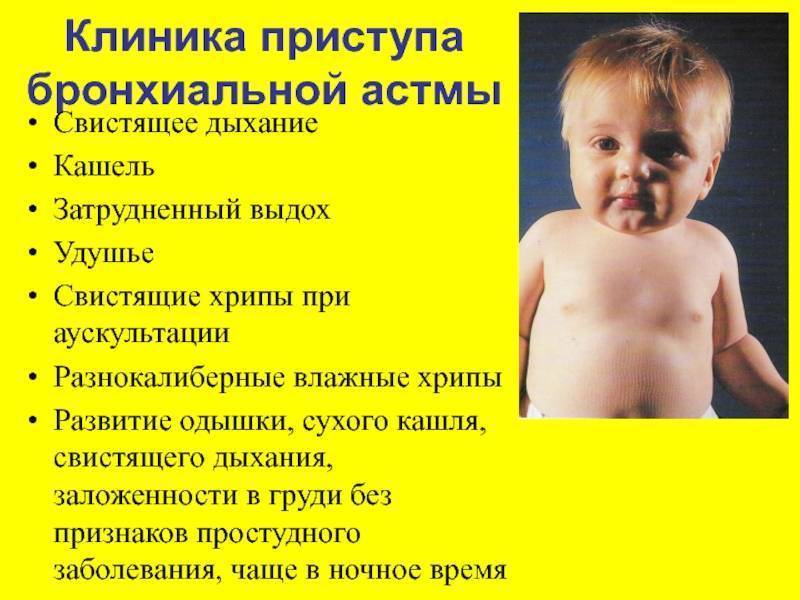 Лающий кашель у ребенка с насморком и без: 2 главные причины, симптомы, как лечить, профилактика