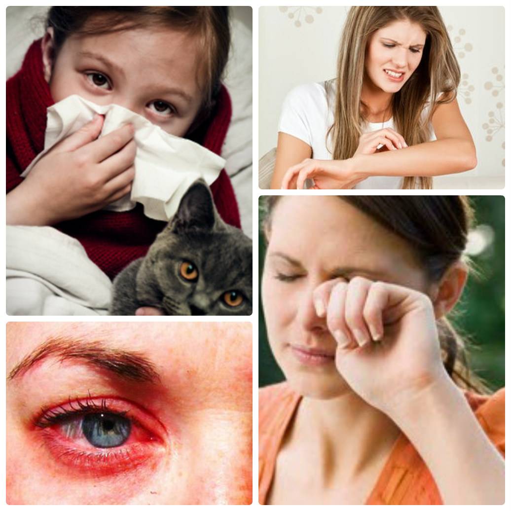 Аллергия на кошек у детей: симптомы и лечение
