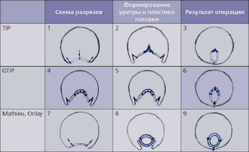 Saline Penis