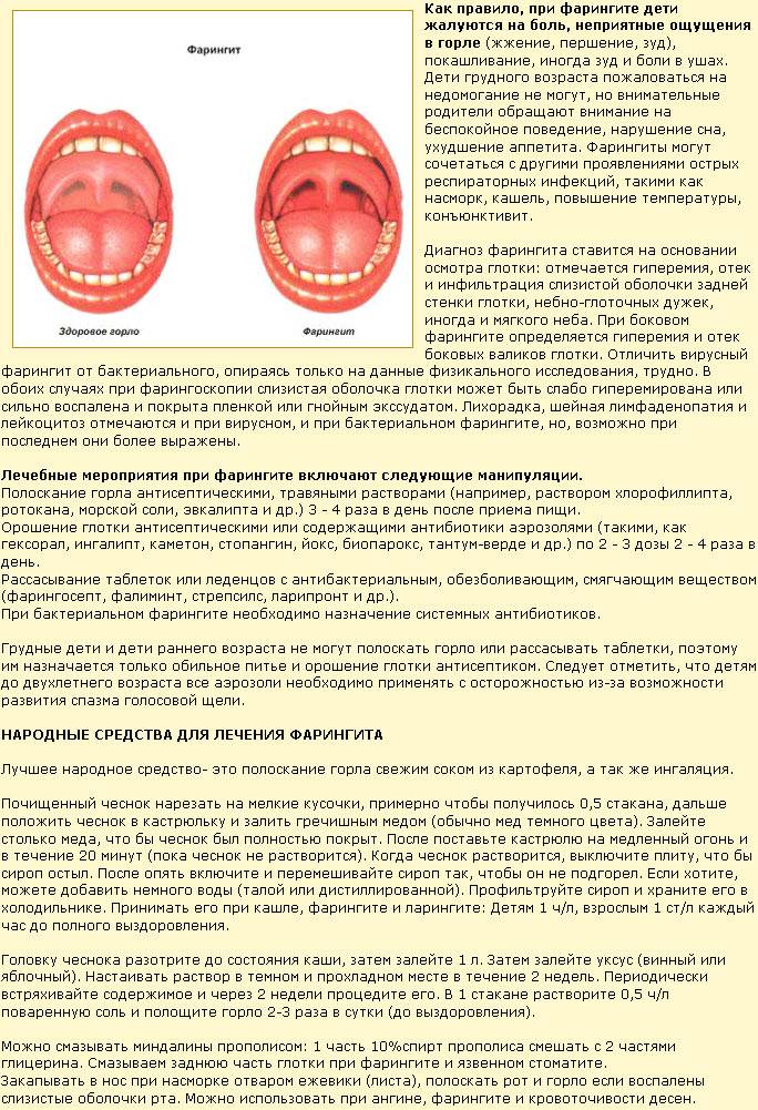 Ларингит схема лечения у детей