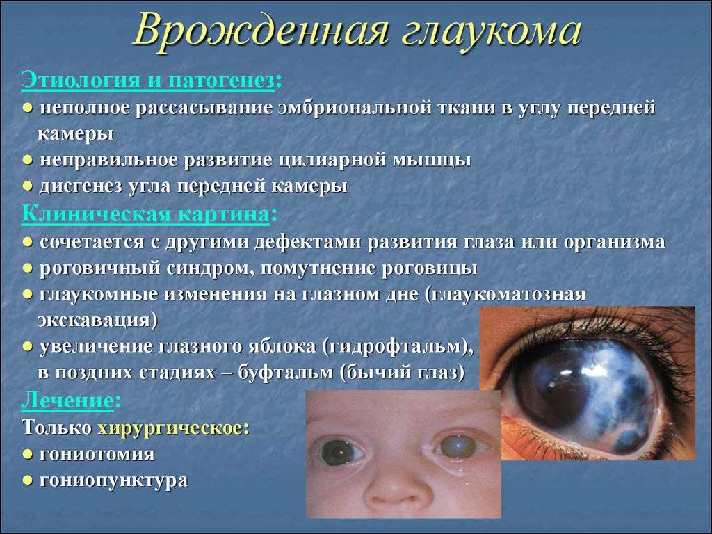 По каким причинам новорожденный ребенок закатывает глаза, диагностика и лечение