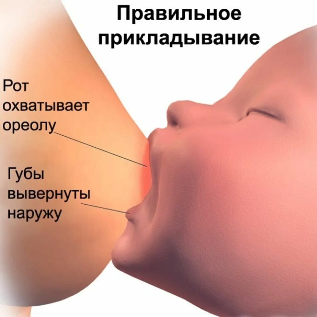 Новорожденный заглатывает воздух. Правильное прикладывание ребенка при грудном вскармливании. Правильное прикладывание к груди. Прикладывание ребенка к груди. Правильный захват груди.