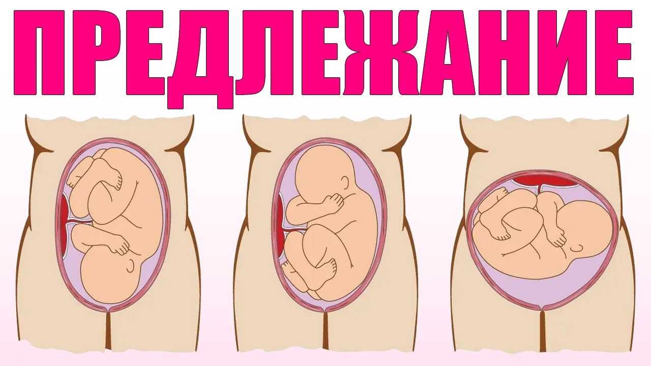 36 неделя беременности: фото, узи, вес плода, роды