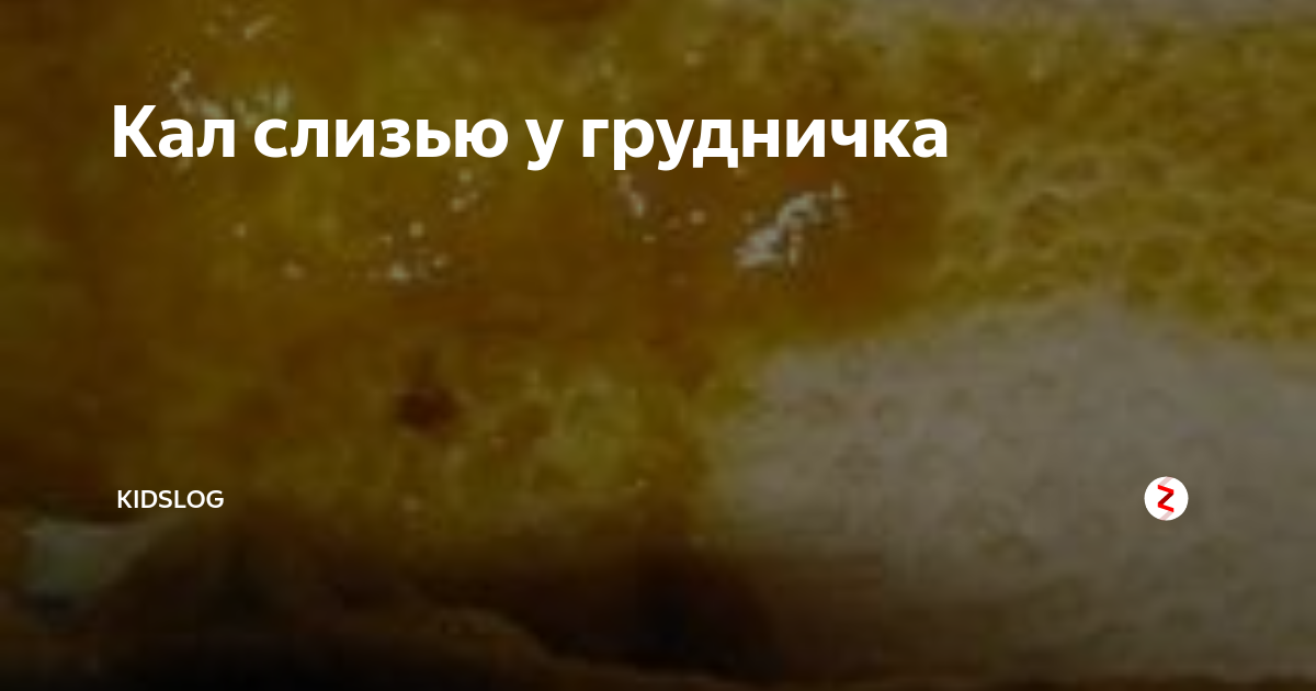 Слизь у новорождённого в стуле: причины, стоит ли волноваться? что делать при появлении слизи у новорождённого в стуле - автор екатерина данилова - журнал женское мнение