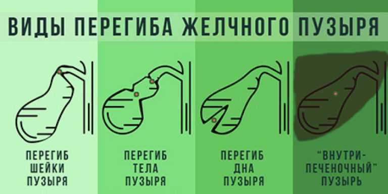 Деформация желчного пузыря у ребенка: причины и лечение