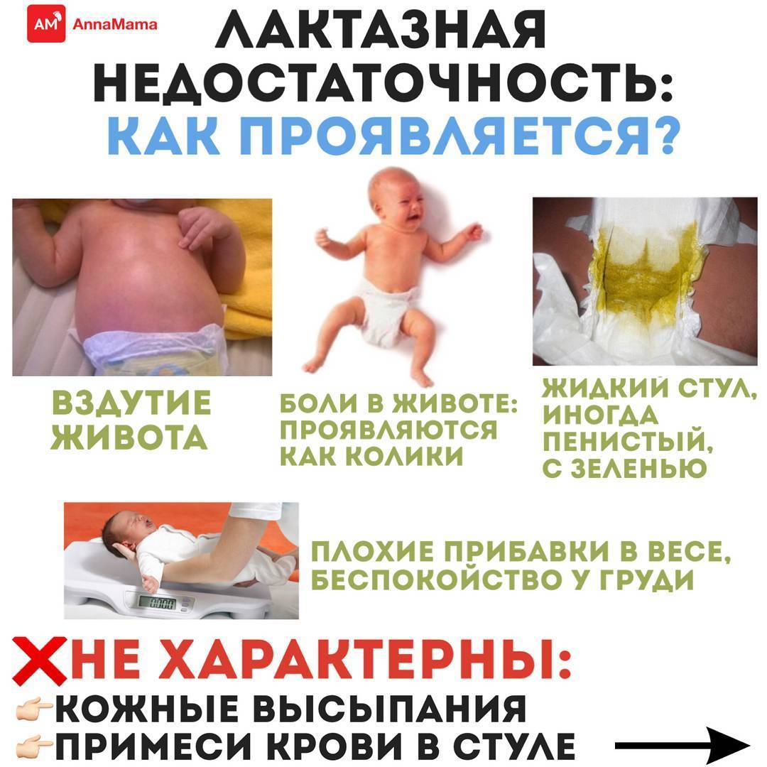 Лактазная недостаточность у детей - симптомы болезни, профилактика и лечение лактазной недостаточности у детей, причины заболевания и его диагностика на eurolab