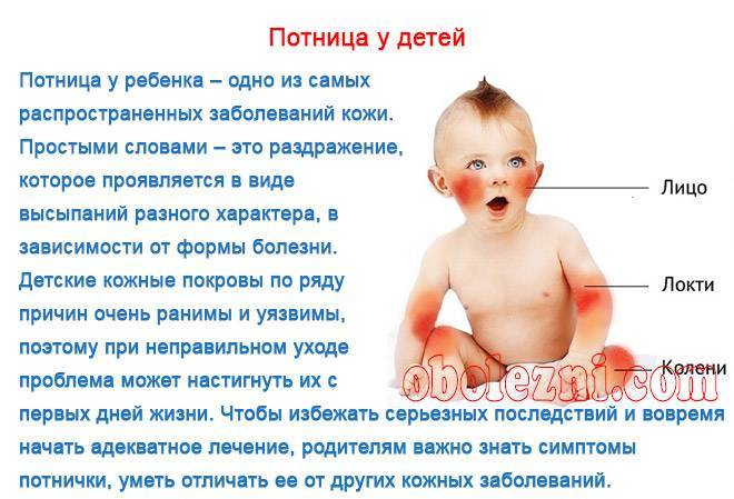 Как у грудничка отличить потничку от аллергии: что это такое, кто больше подвержен