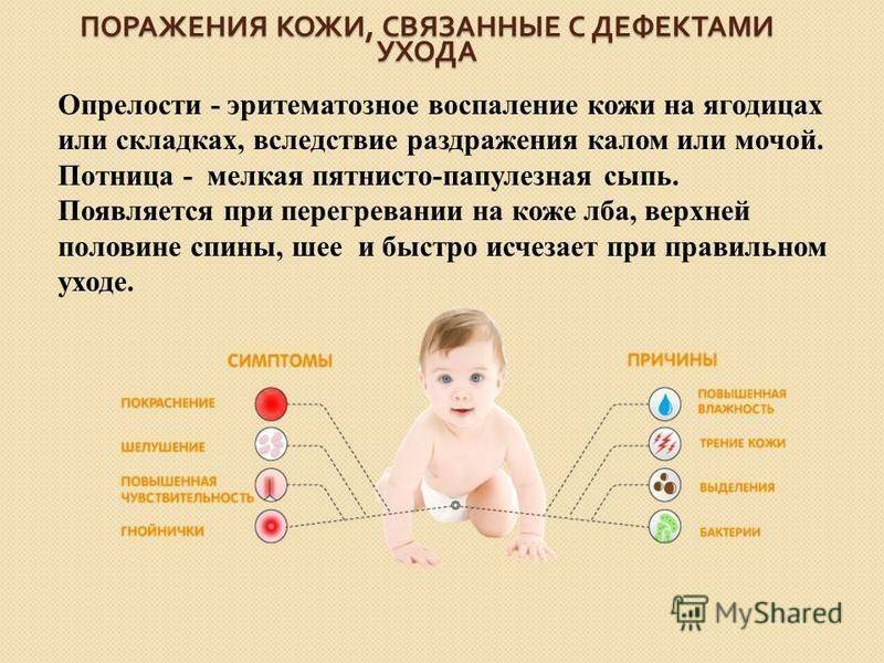 Как лечить потницу у новорожденных на шее или лице