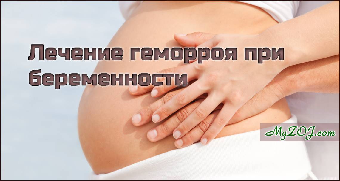 Лечение геморроя при беременности | статьи медицинского центра «см-клиника»