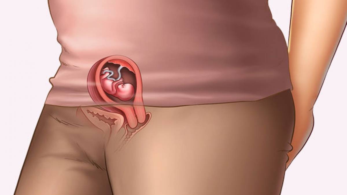 10 недель беременности описание и фото — евромедклиник 24