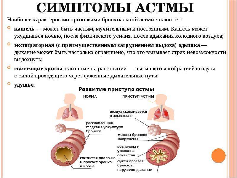 Бронхит у детей: симптомы и диагностика, как лечить обструктивный бронхит у детей | ирс®19