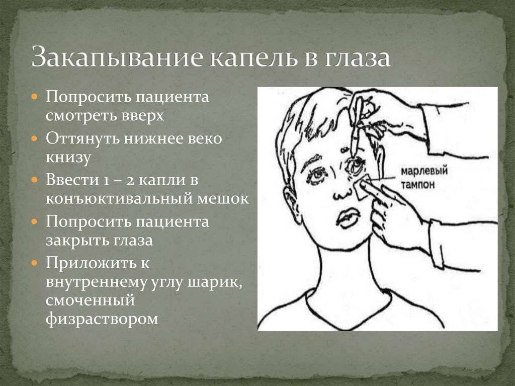 Как правильно закапывать капли в нос: алгоритм и техника