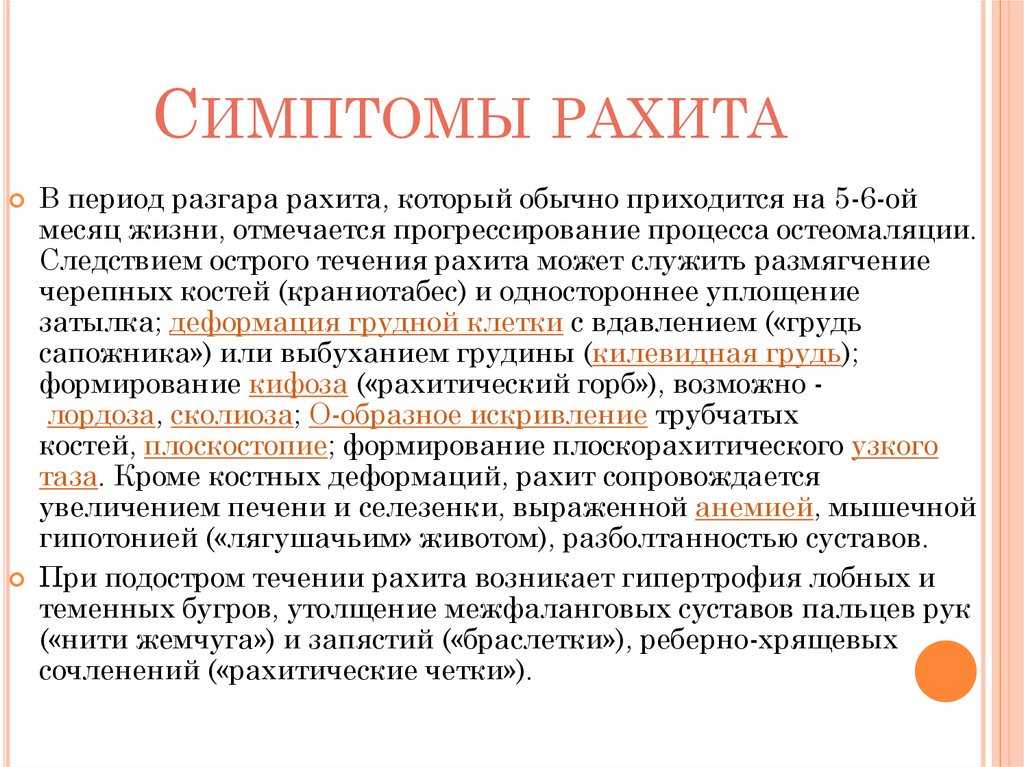 Как выявить рахит у ребенка? о симптомах рахита и его профилактике рассказывает врач-педиатр