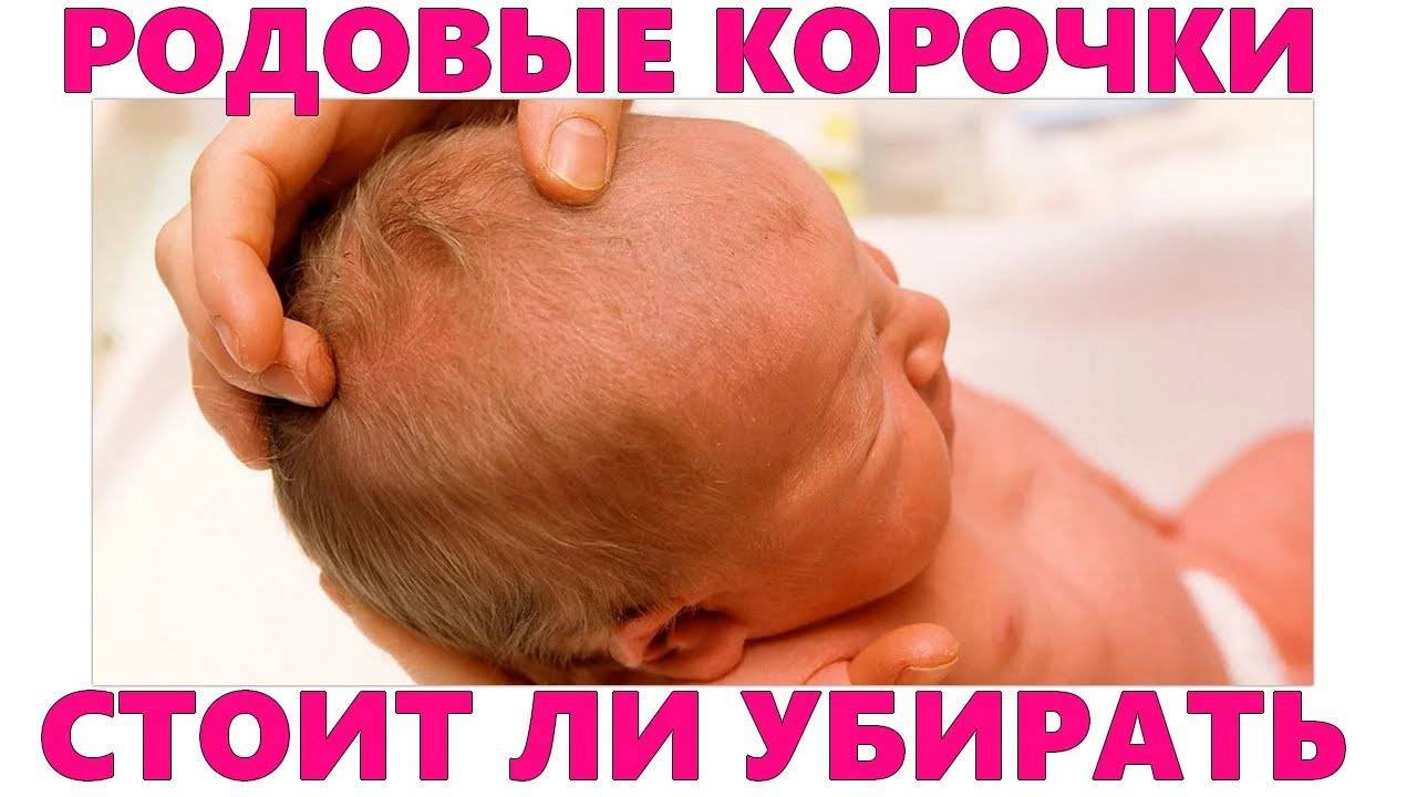 Новорожденные дети: все о родничке