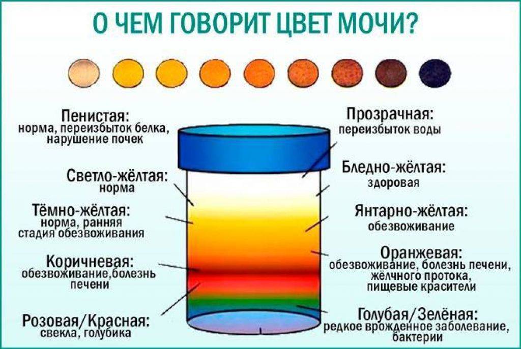 Когда появляется запах мочи у грудничка. моча грудничка: какой нормальный цвет и запах у мочи новорожденного