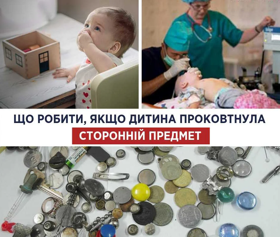 Что делать, если ребенок проглотил инородный предмет