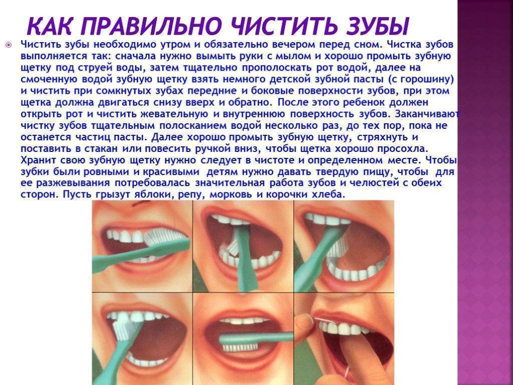 Удаление молочных зубов в домашних условиях и у врача: 3 показания, как удалить, последствия